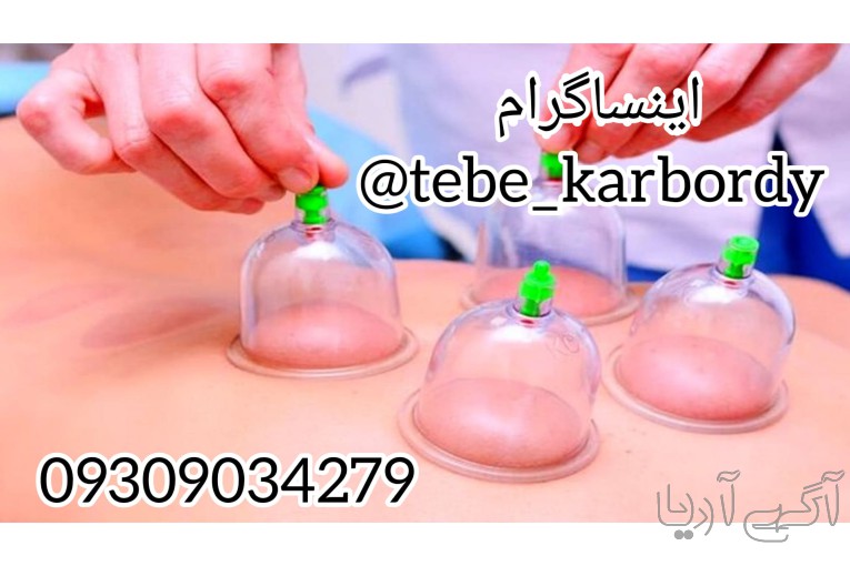 انجام دهنده تمامی حجامت های اسلامی 