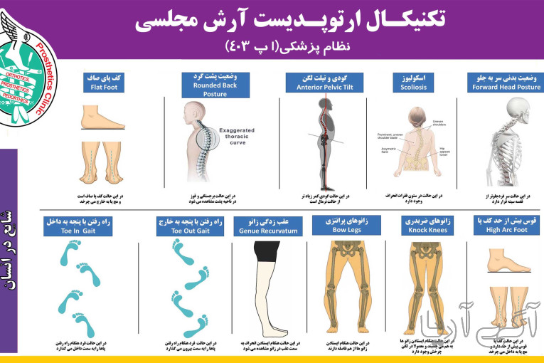 ارتوپدی فنی مجلسی | پروتز، ارتروز و اعضای مصنوعی