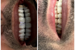 دندانپزشکی تخصصی نسیم قیطریه