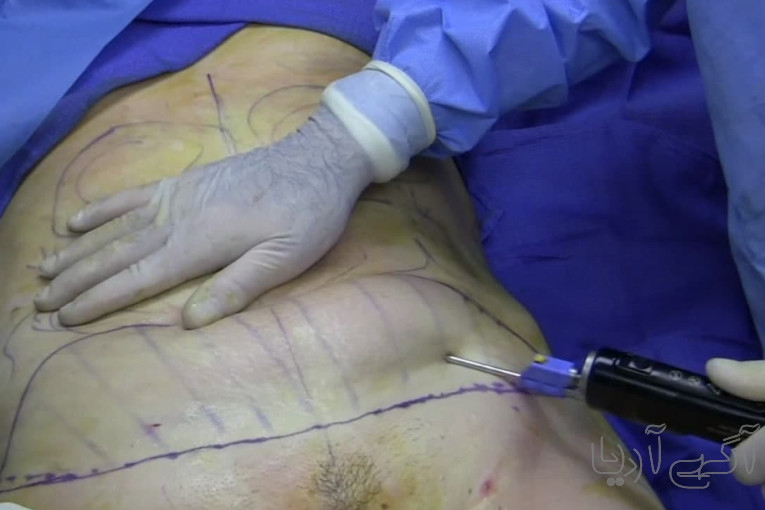  پرستاری در منزل تبریز | خدمات پزشکی و پرستاری ۲۴ ساعته | تبریز نرس ۰۹۲۱۴۴۹۶۱۸۱