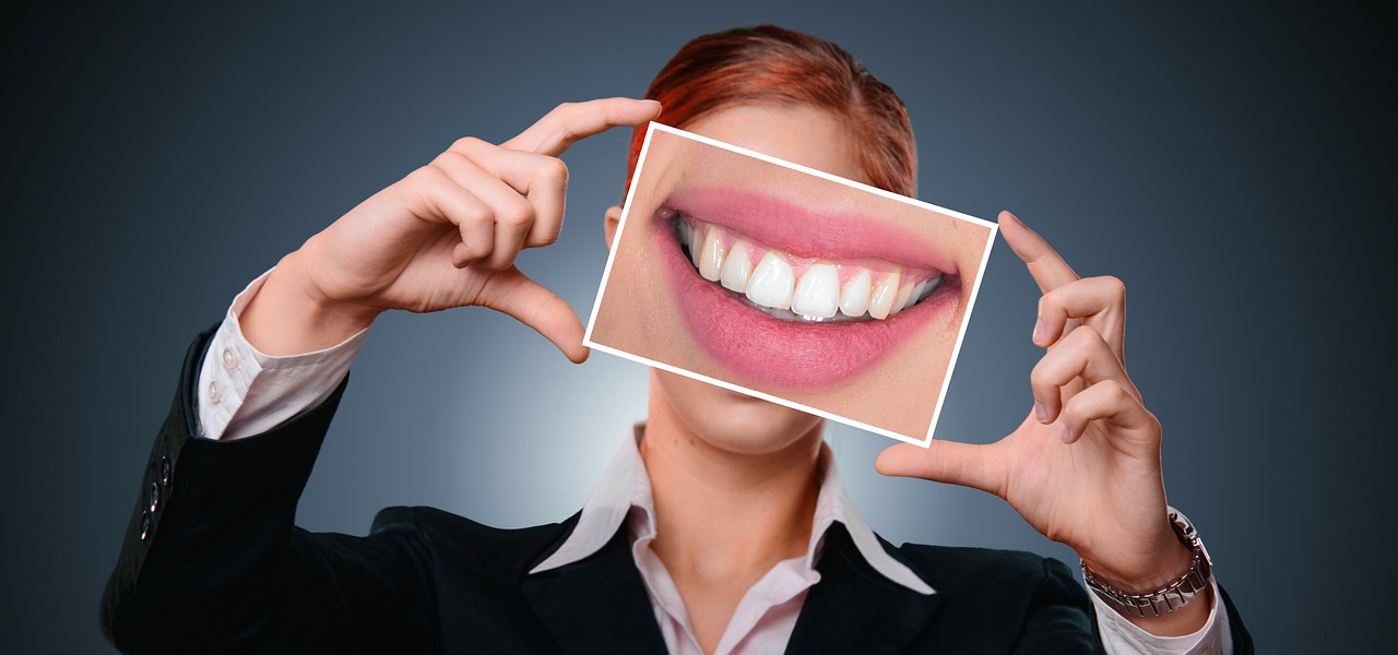 عکس گذاری حرفه ای در آگهی شیپور